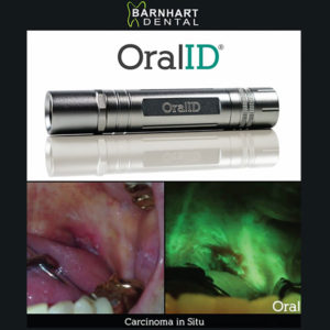 Oral ID Light