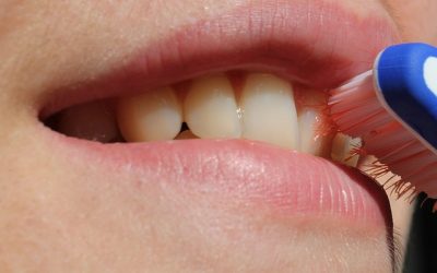 What is Gingivitis and How is it Treated?