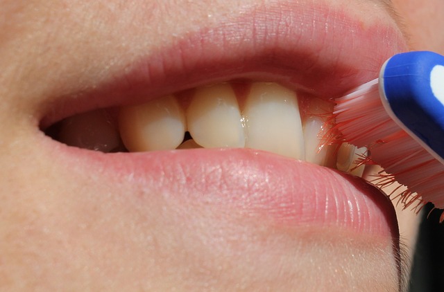 What is Gingivitis and How is it Treated?
